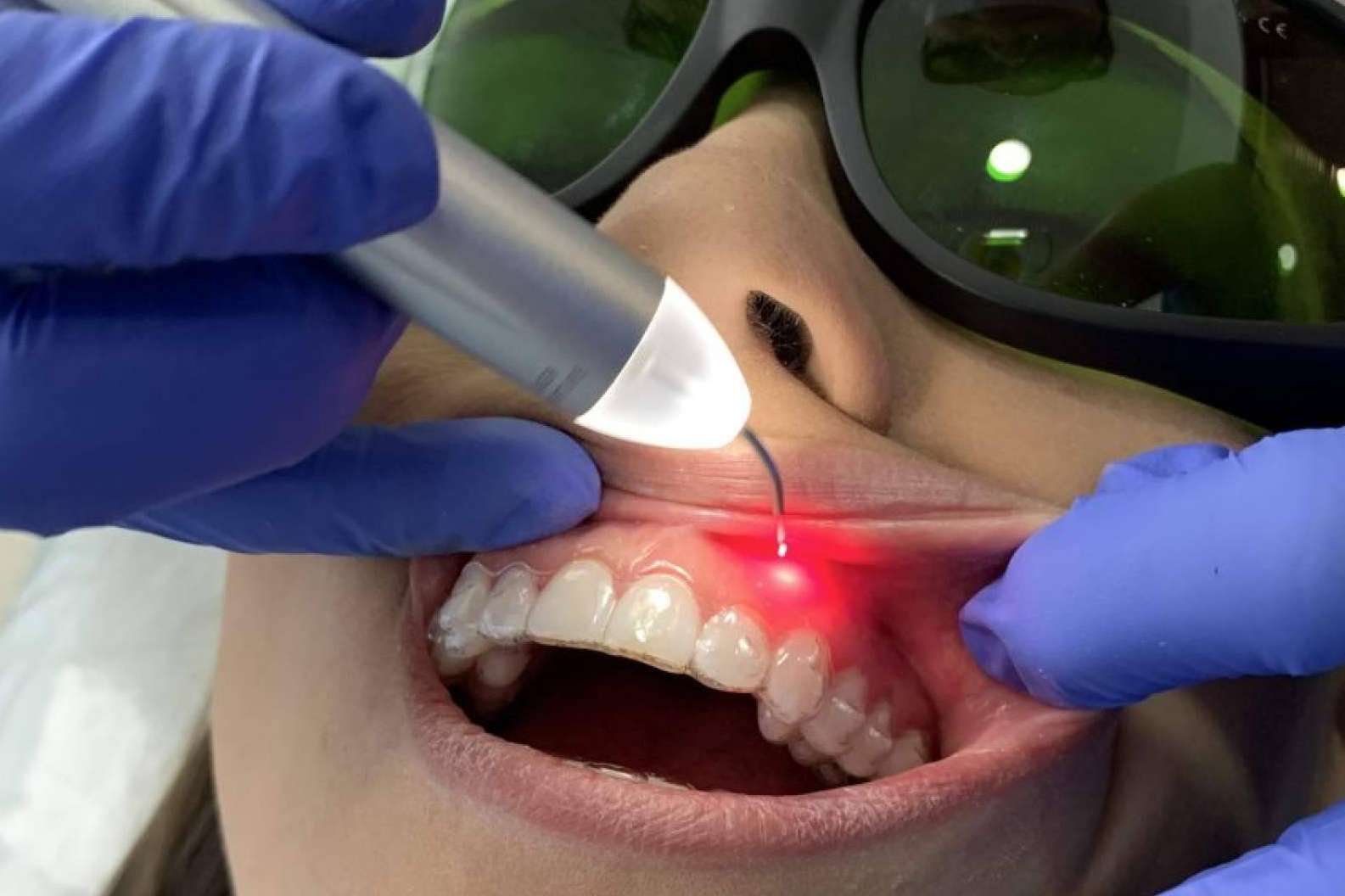 Dental Implantologie ofrece las últimas tecnologías de estética dental