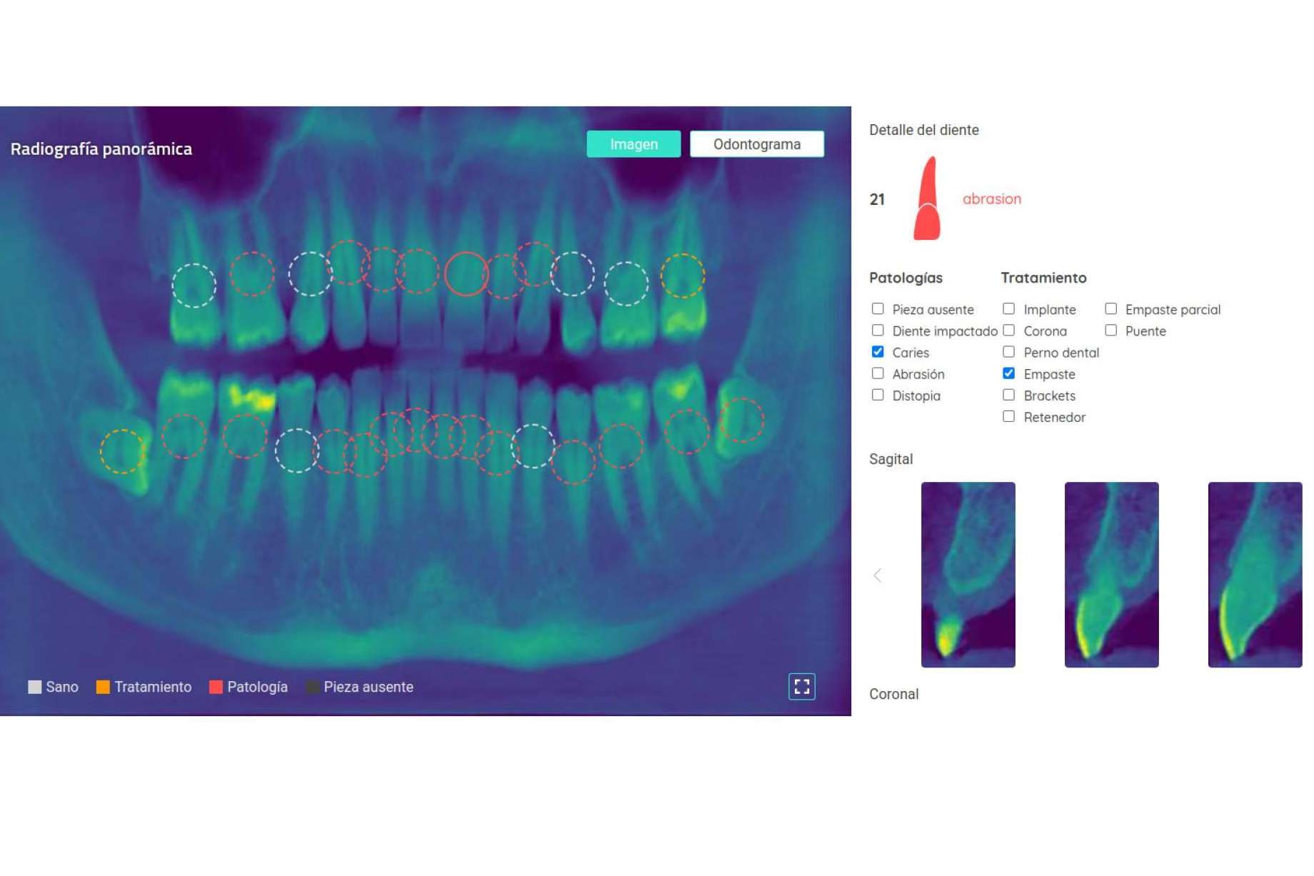 El uso de la visión artificial en el mundo odontológico de la mano de Dentomo