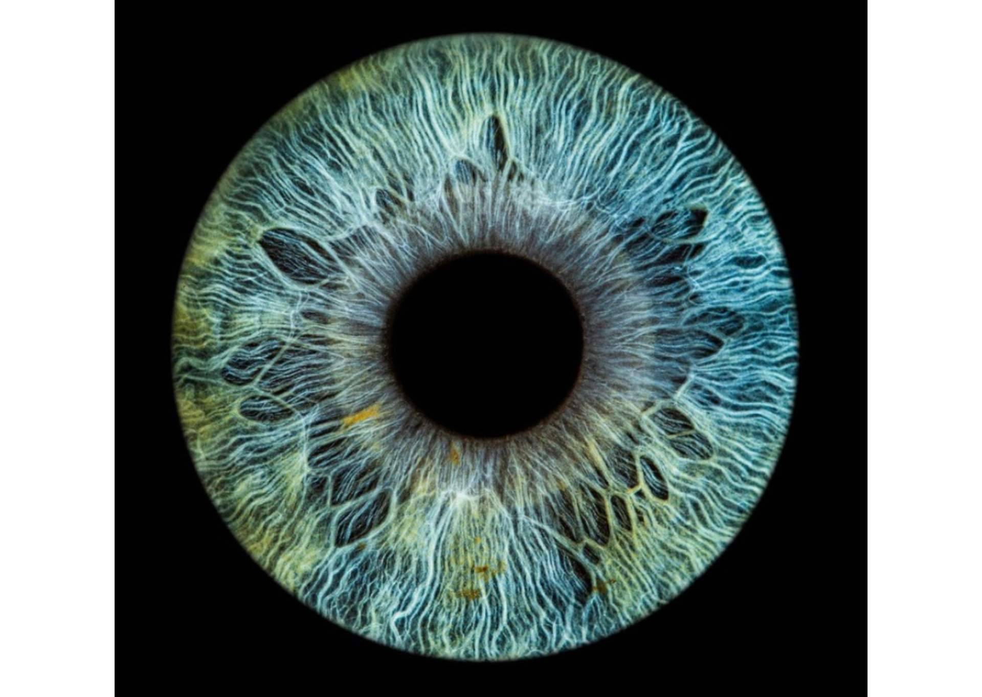 La clínica Eyecos y su software con tecnología puntera para evaluar el color de los ojos
