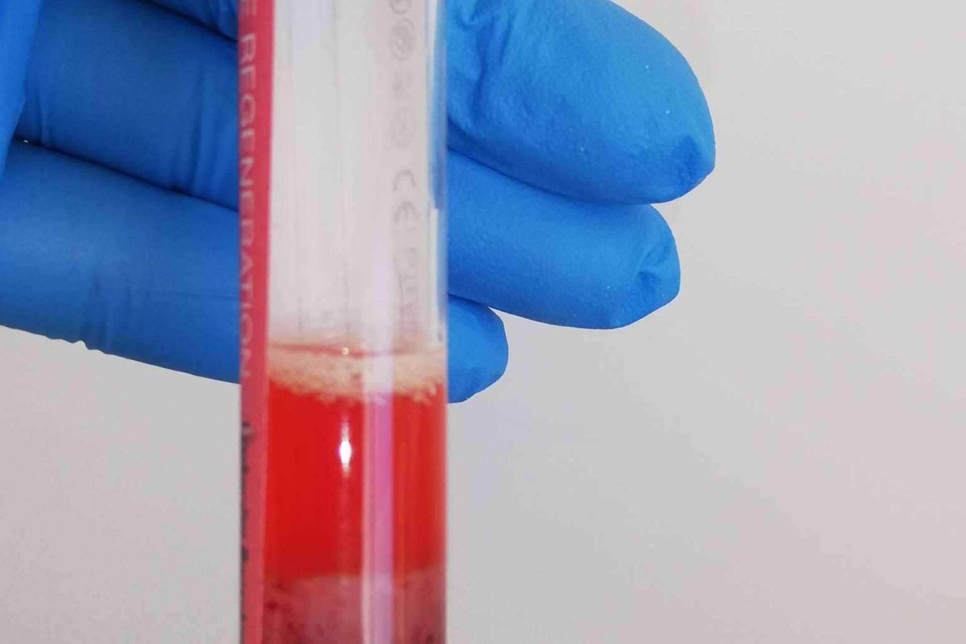 Acceder a terapias con células madre en la Clínica Biorigenera
