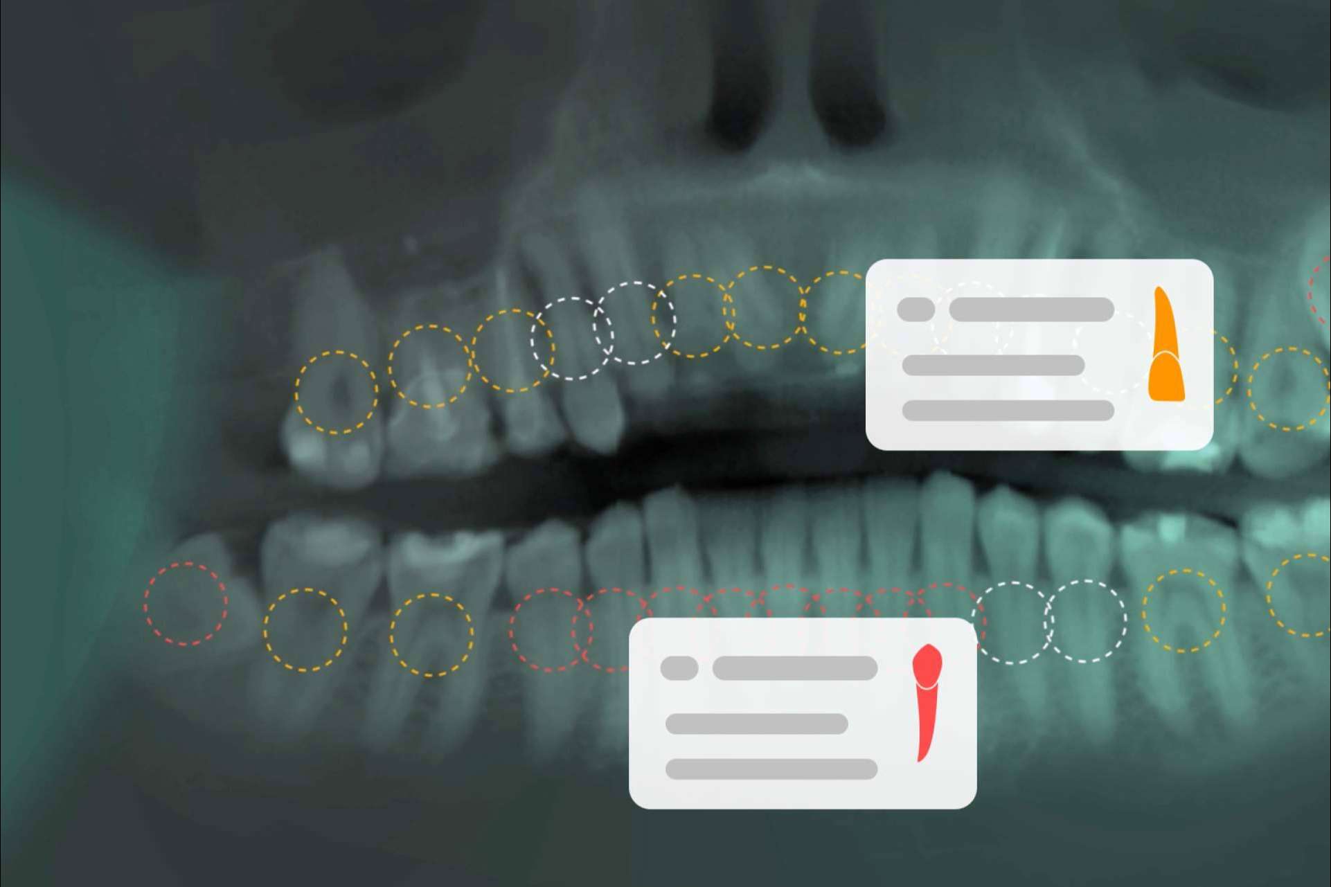 La inteligencia artificial aterriza en el ámbito de la odontología de la mano de Dentomo