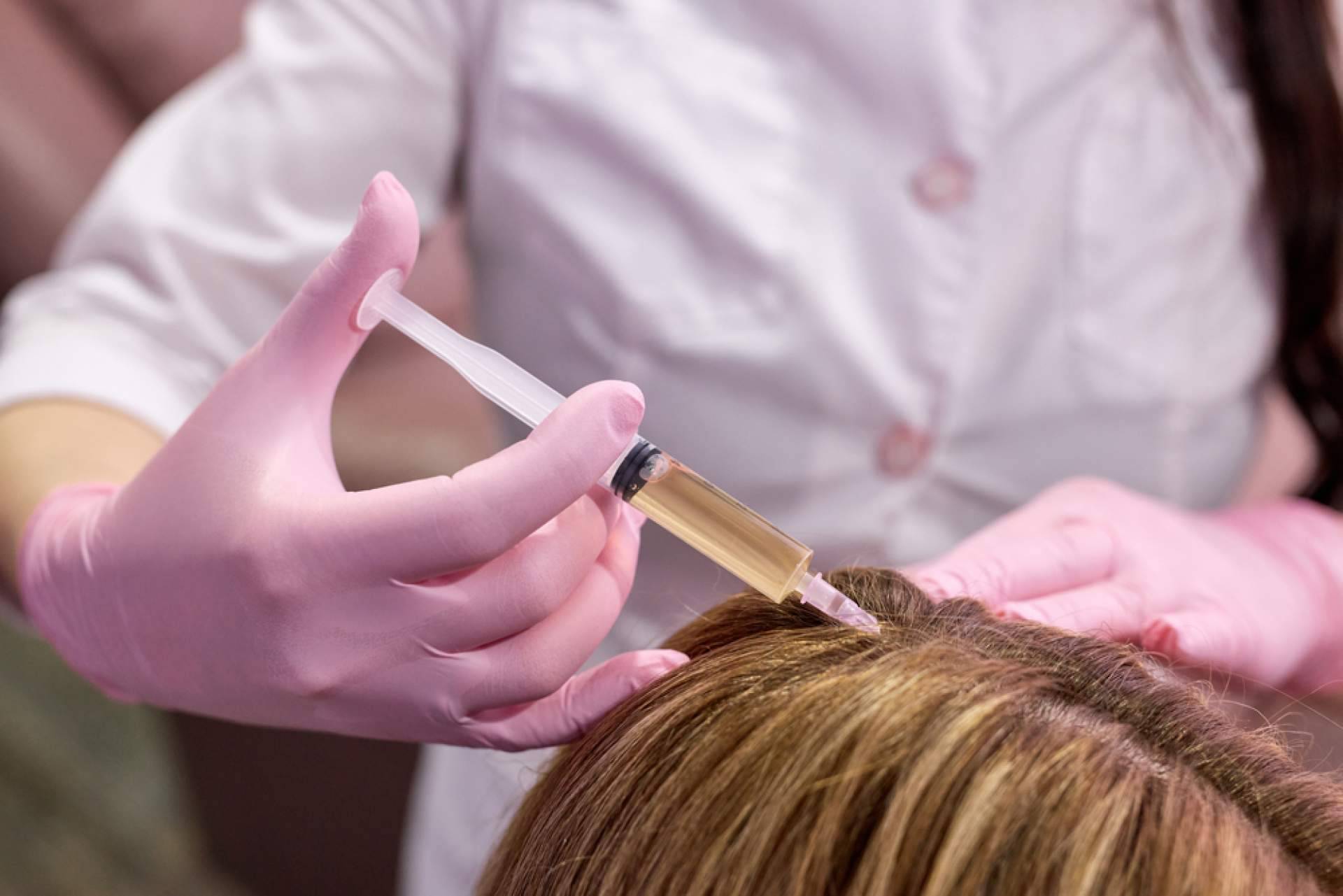 Solucionar la alopecia difusa femenina capilar de la mano de Capilar Innovation Clinic By Doctor Jesús Aníbal Mora