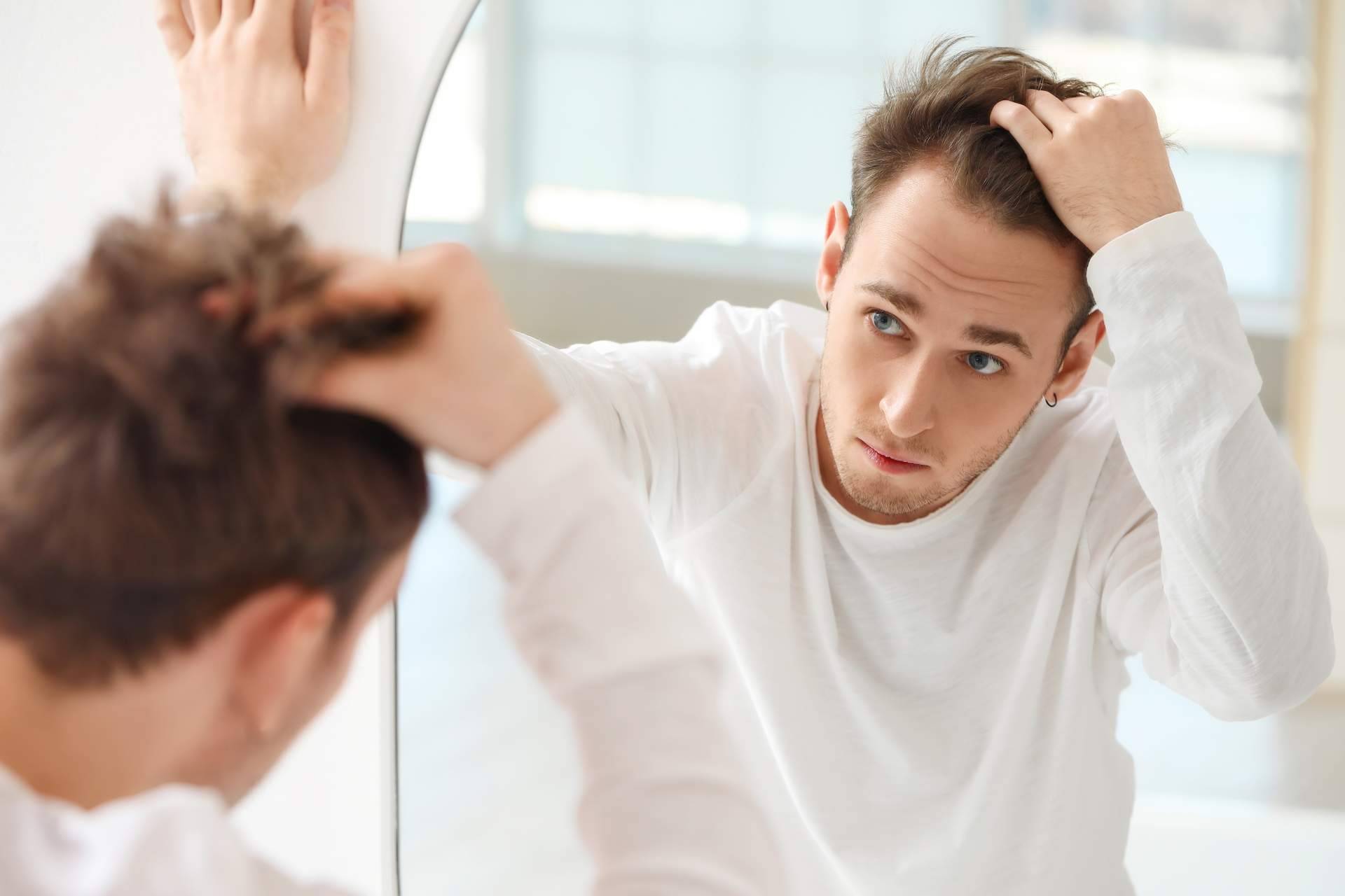 Xpecia hombre, una solución para combatir la alopecia