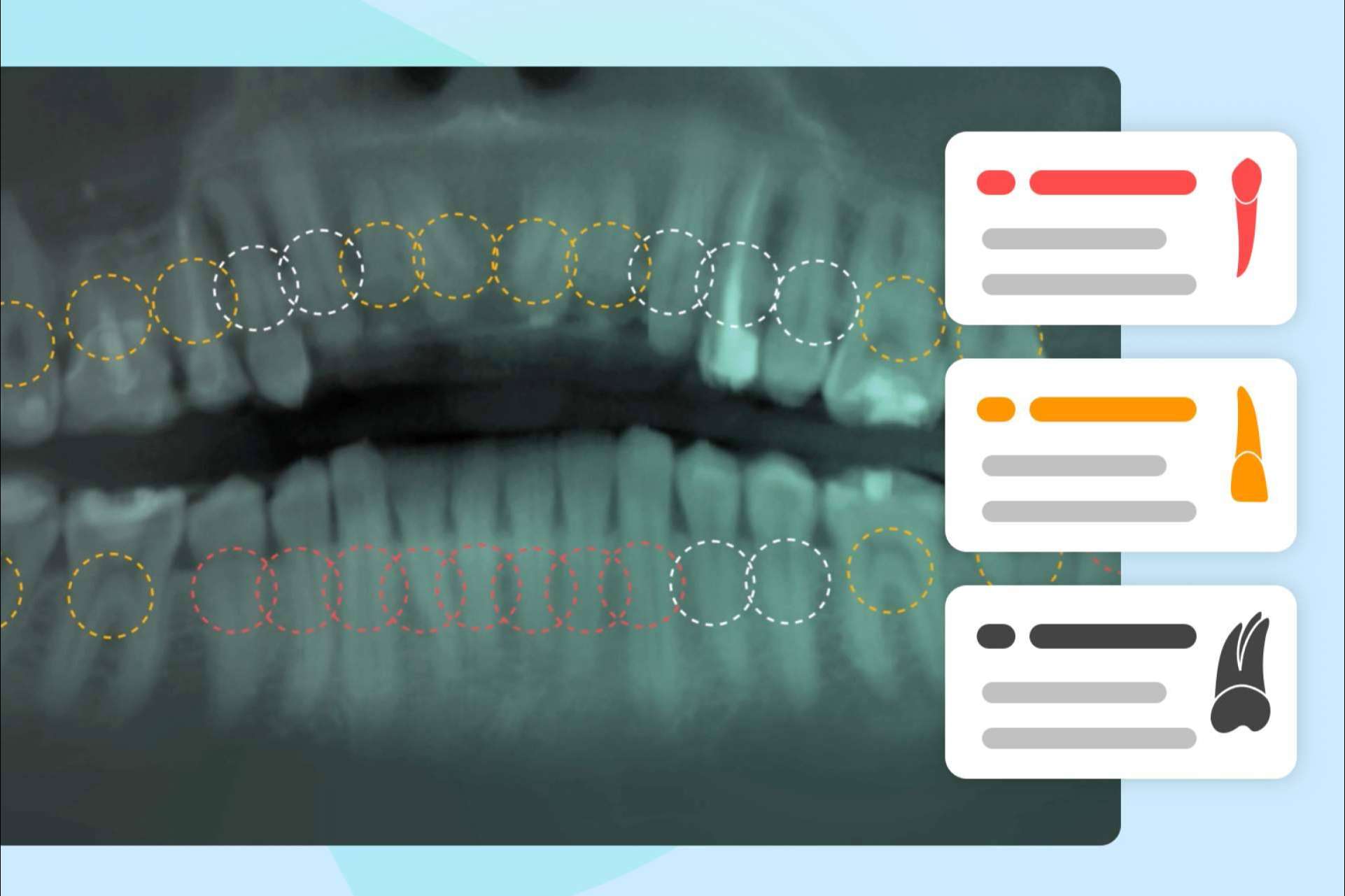 Las características del software dental IA