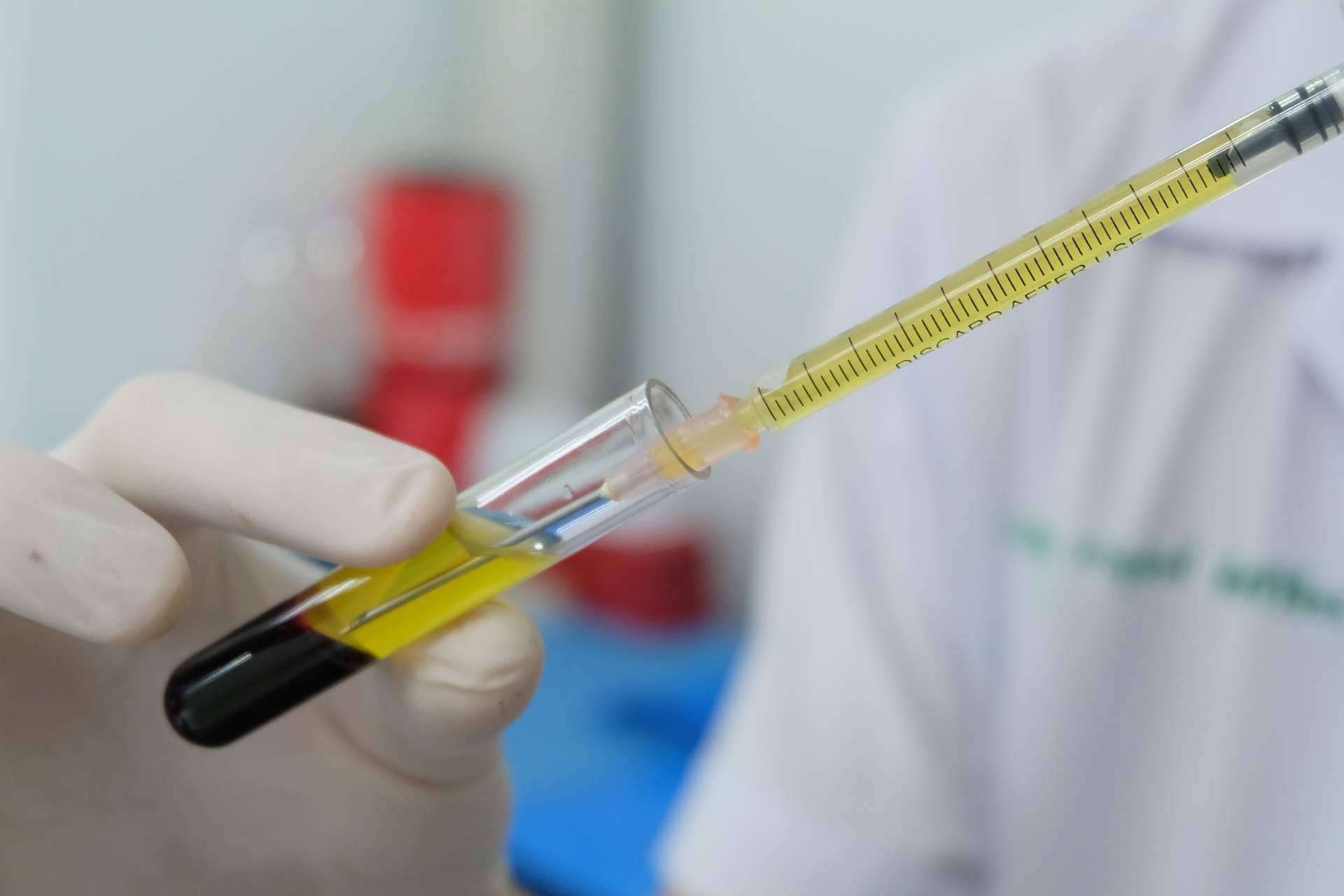 Centro Estética El Pilar y su innovador tratamiento de plasma rico en plaquetas