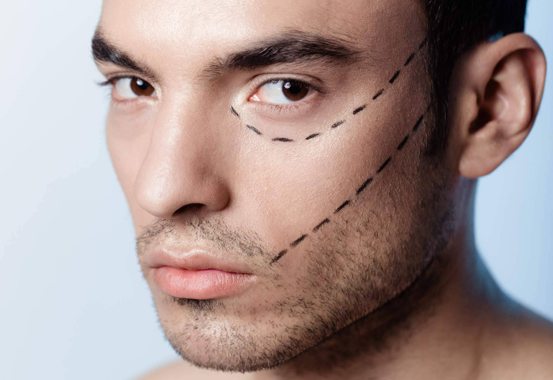 Tendencias emergentes y enfoques personalizados en la medicina estética masculina