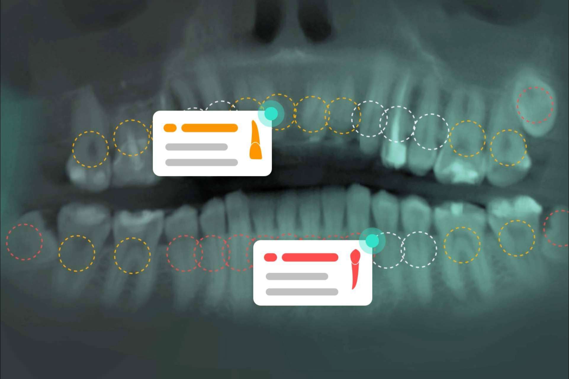 La revolucionaria solución en forma de software para dentistas potenciado por inteligencia artificial de Dentomo