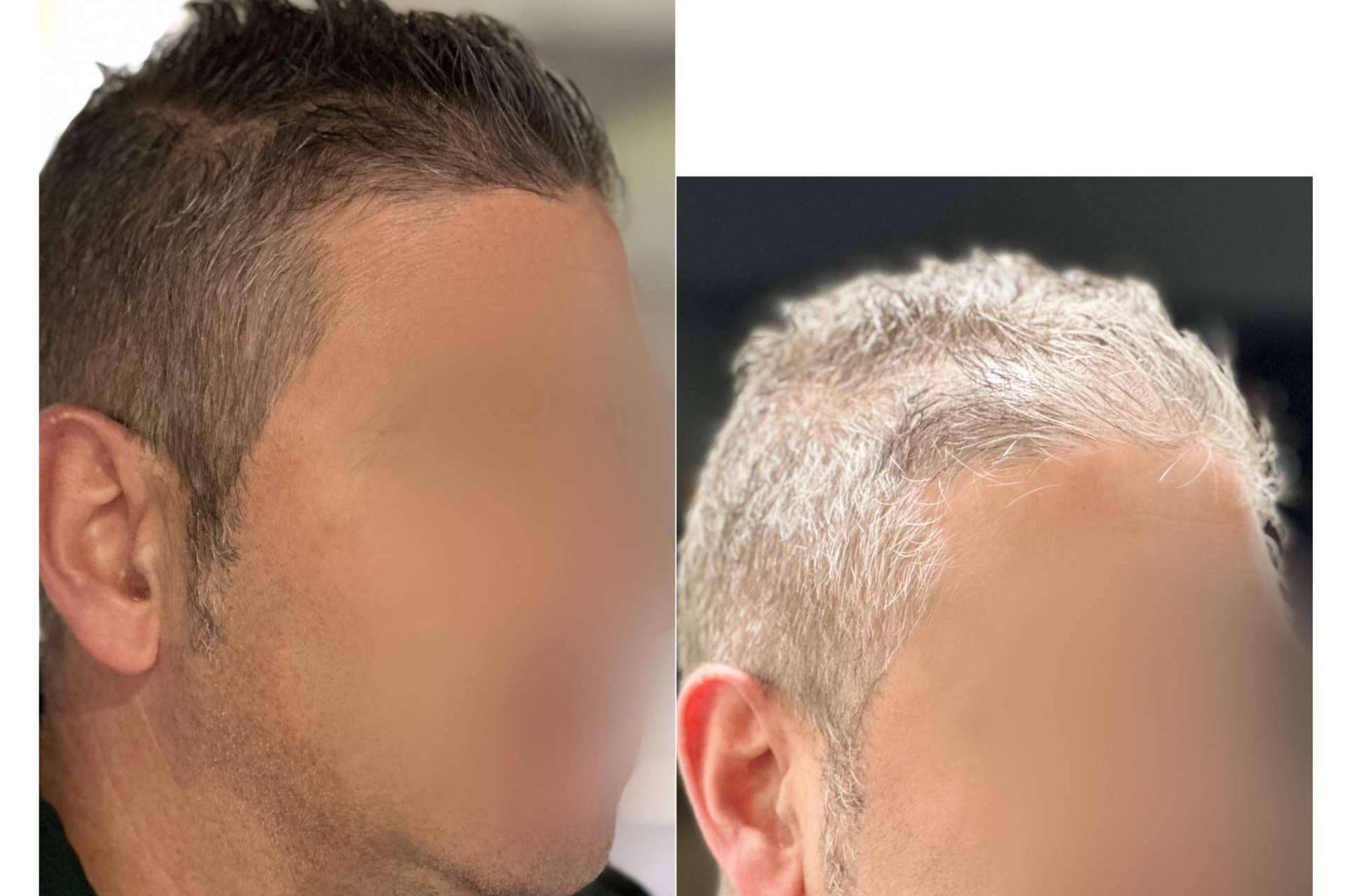 Cera Negra Anti-Canas de fijación perfecta; la revolución en el cuidado capilar masculino