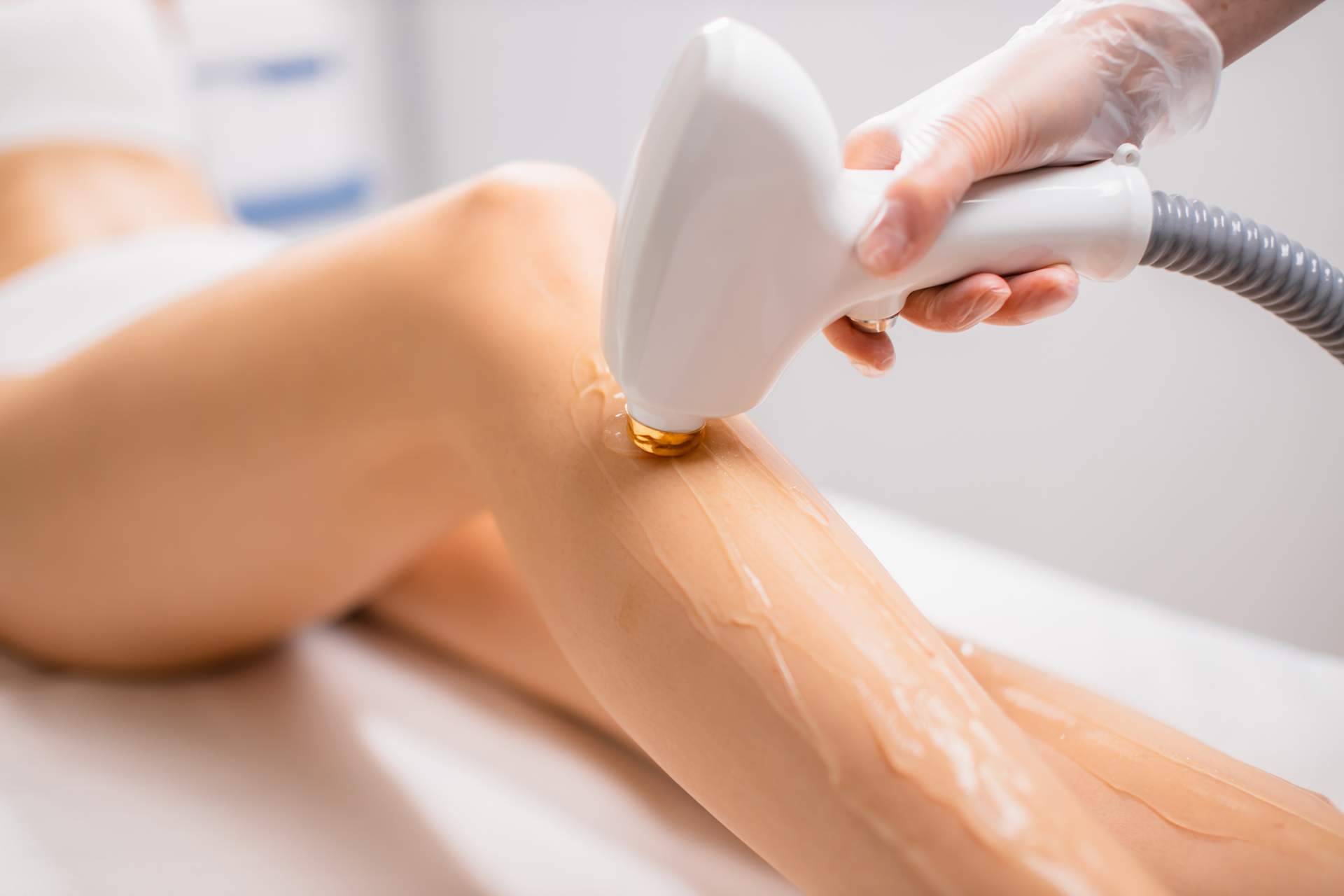 Precauciones para evitar posibles efectos secundarios en la depilación láser de piernas, por 360Clinics