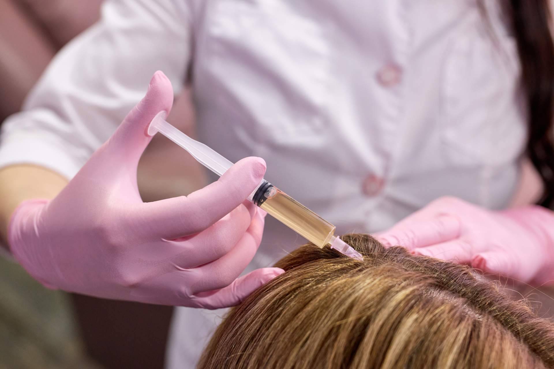 Clínica Capilar Mora ofrece un sistema revolucionario de mesoterapia capilar para recuperar el cabello