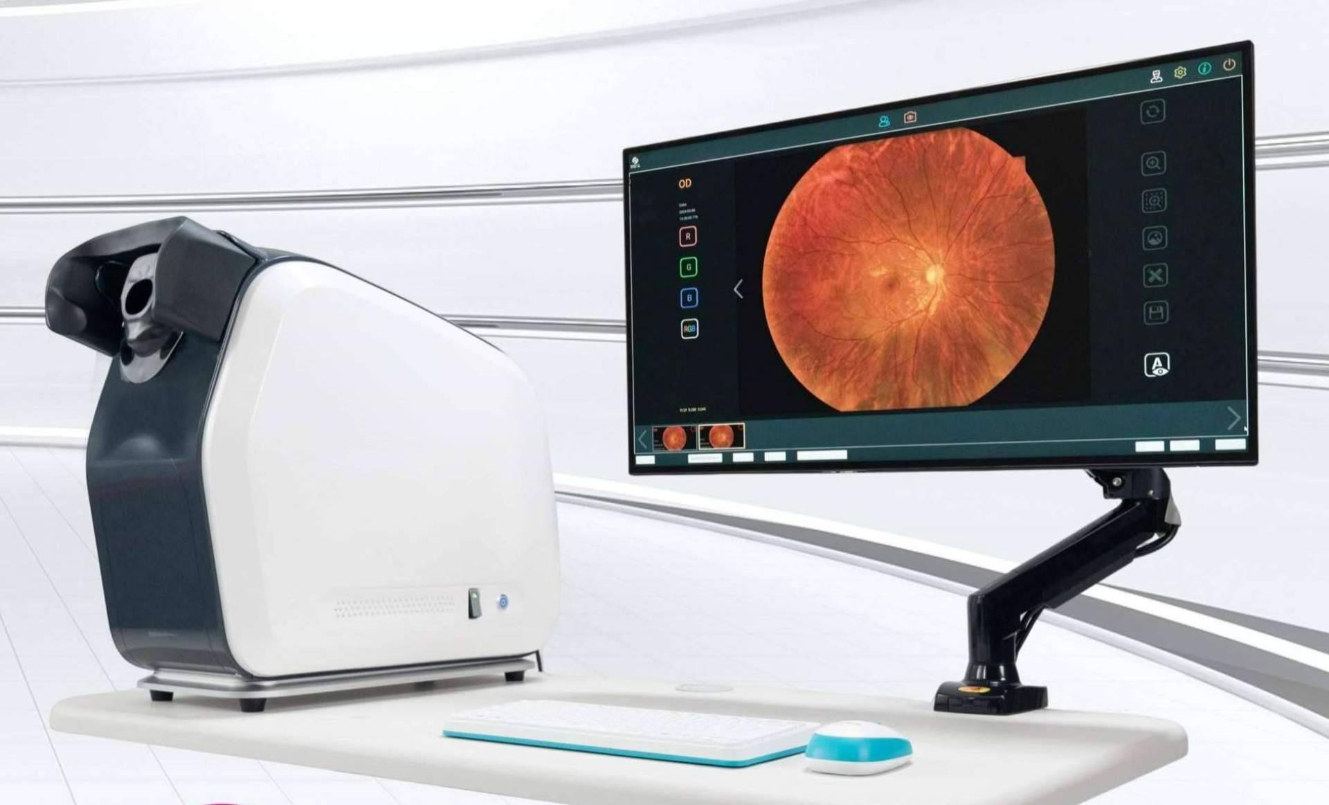 Detección rápida y precisa de anomalías en la retina con retinógrafos de campo amplio de GX2