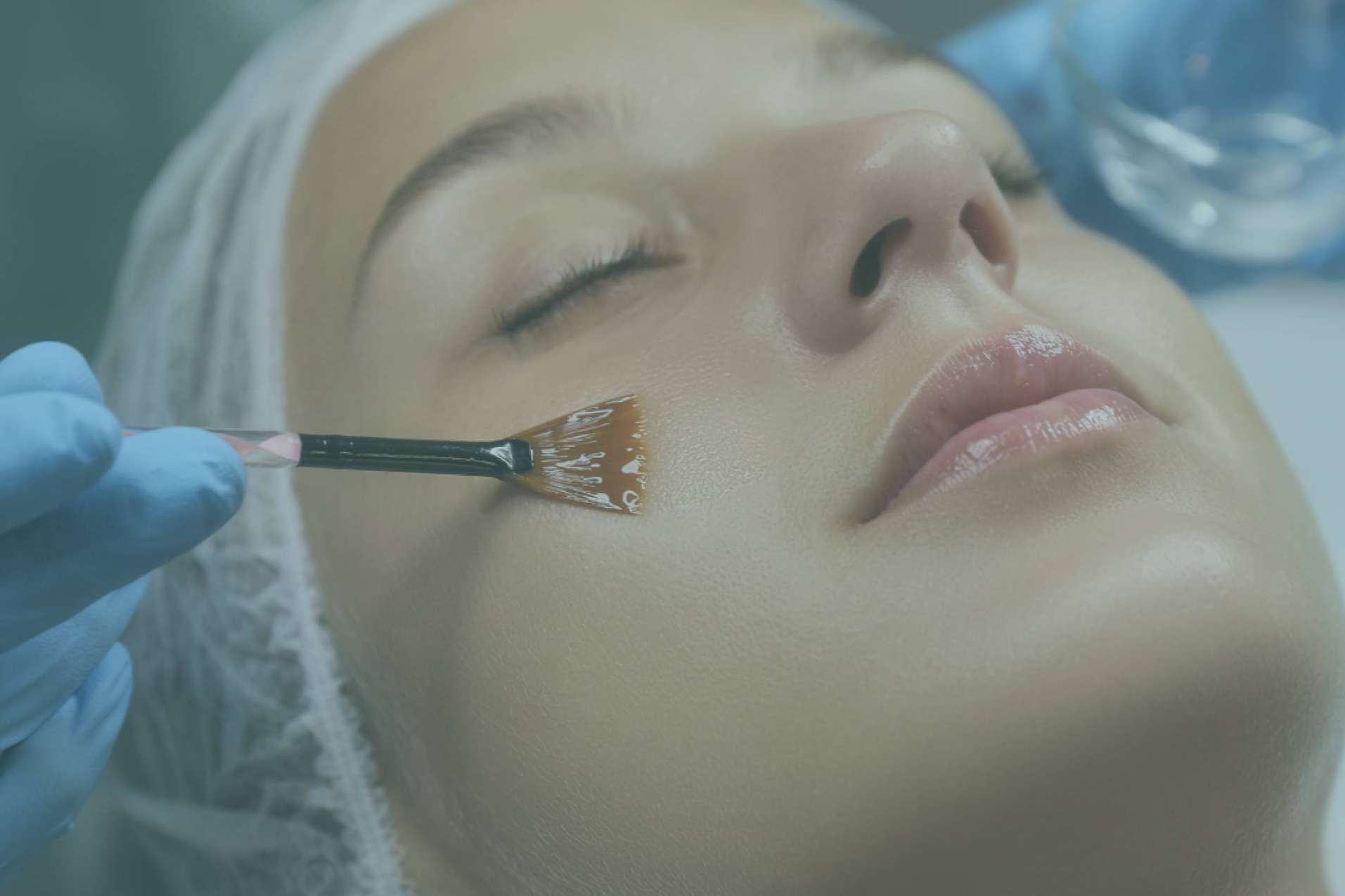 Mejorar el tono y la textura de la piel con sesiones de peeling químico, por Dra. Cecilia Arthur