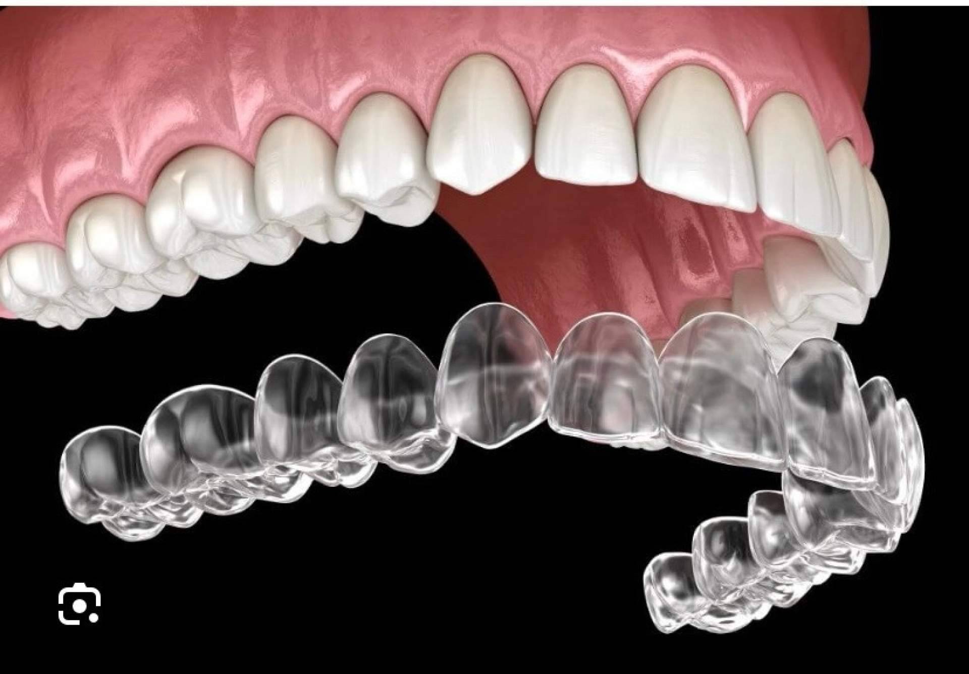 Ortodoncia invisible con tecnología digital; la apuesta de la Clínica Dental Jorge del Corral en Hortaleza, Madrid