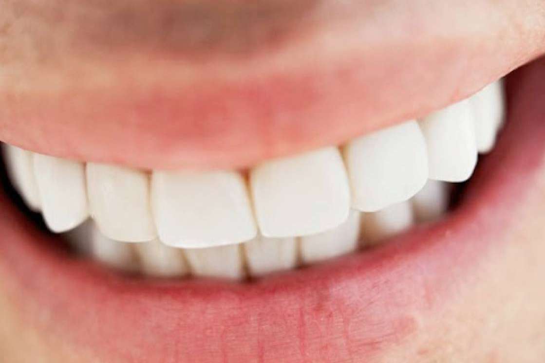 La Clínica Dental Jorge del Corral, en Hortaleza, innova con prótesis fijas de zirconio diseñadas por ordenador