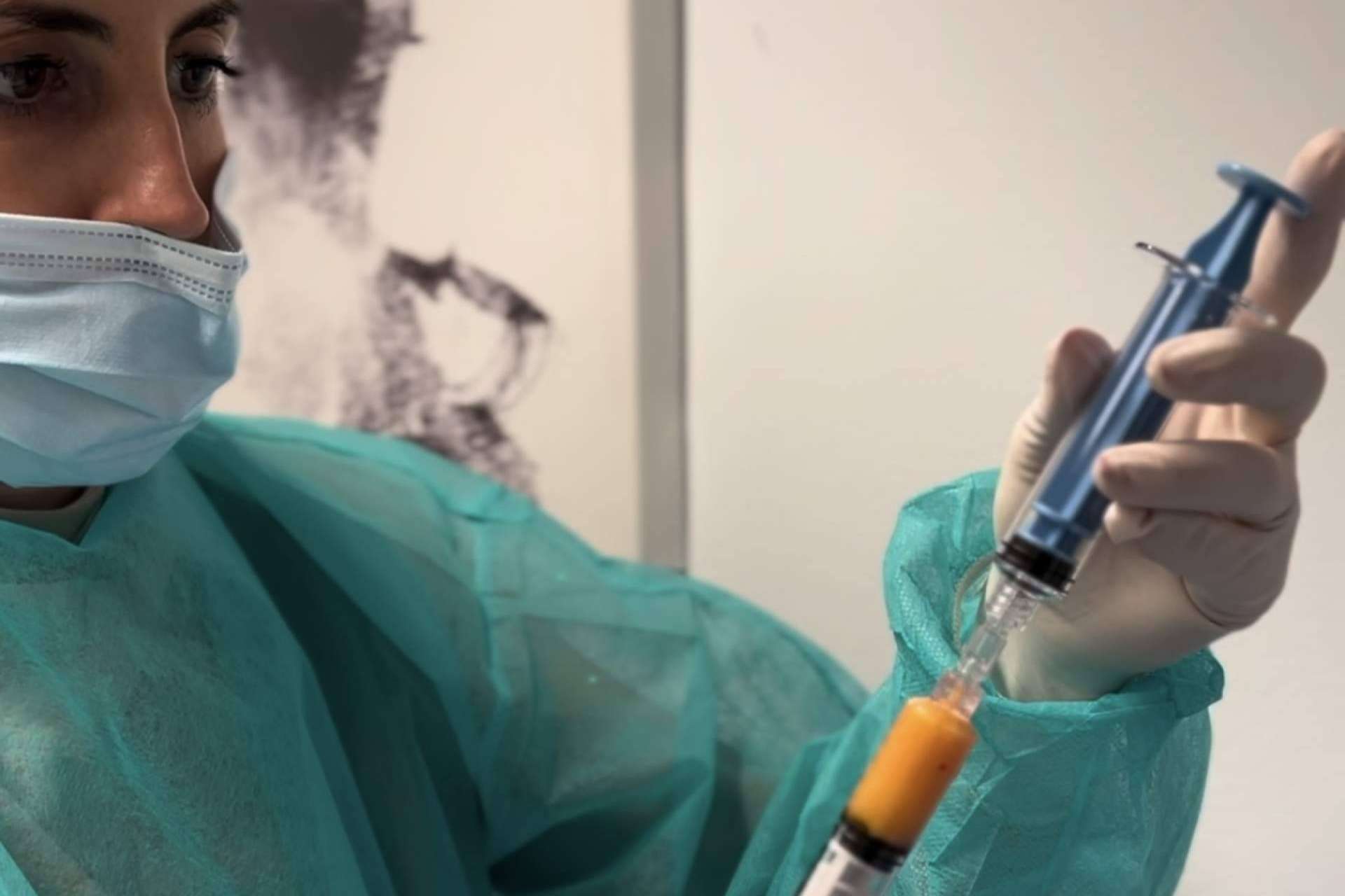 Rejuvenecimiento facial en MD Cliniques; la revolución de SEFFILLER®️ y la regeneración celular autóloga