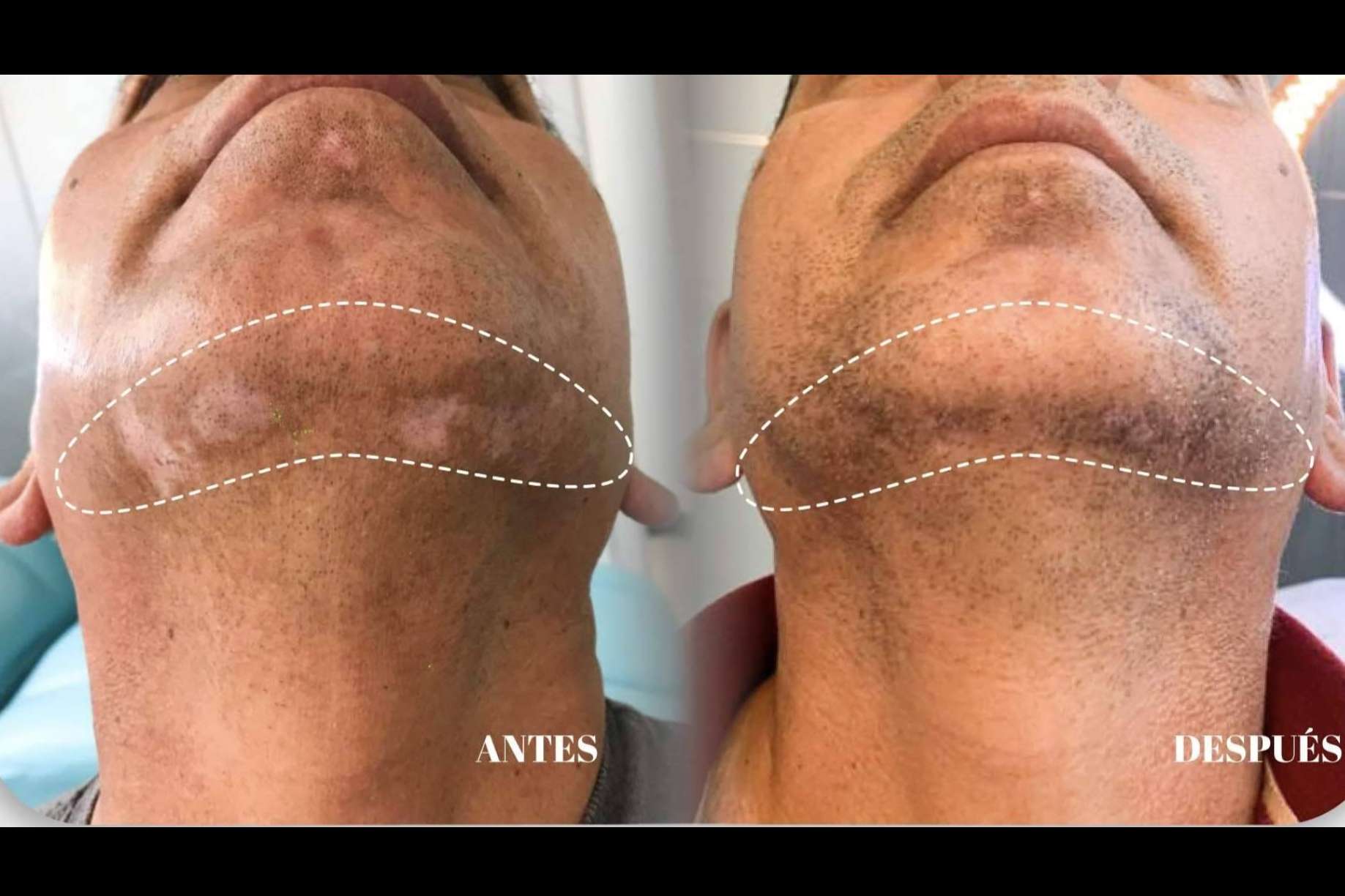 Clínica God Bless fortalece su especialización en vitiligo con la terapia combinada de la Dra. Janeth Arévalo
