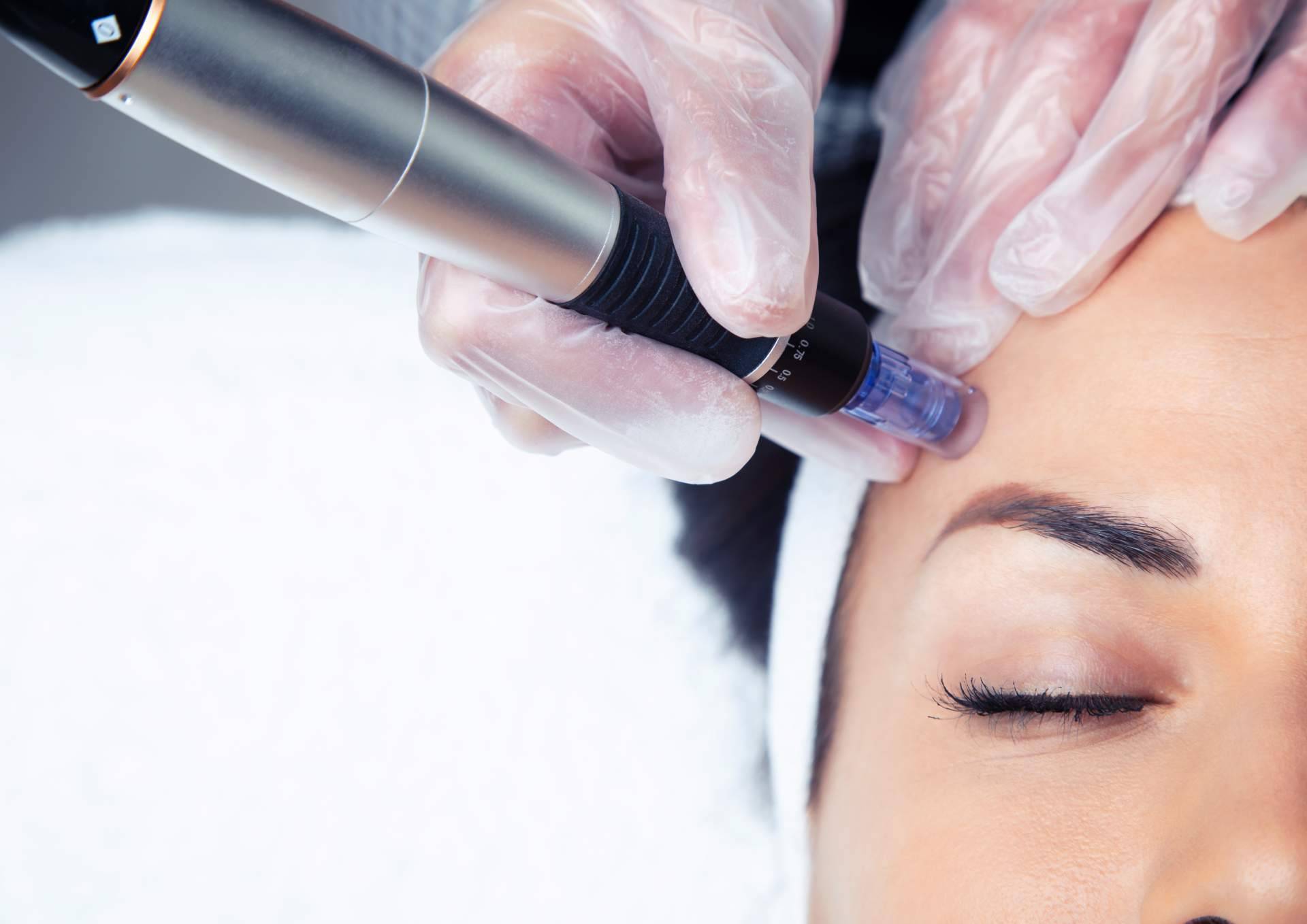 Tratamientos faciales para mejorar la calidad de la piel en primavera