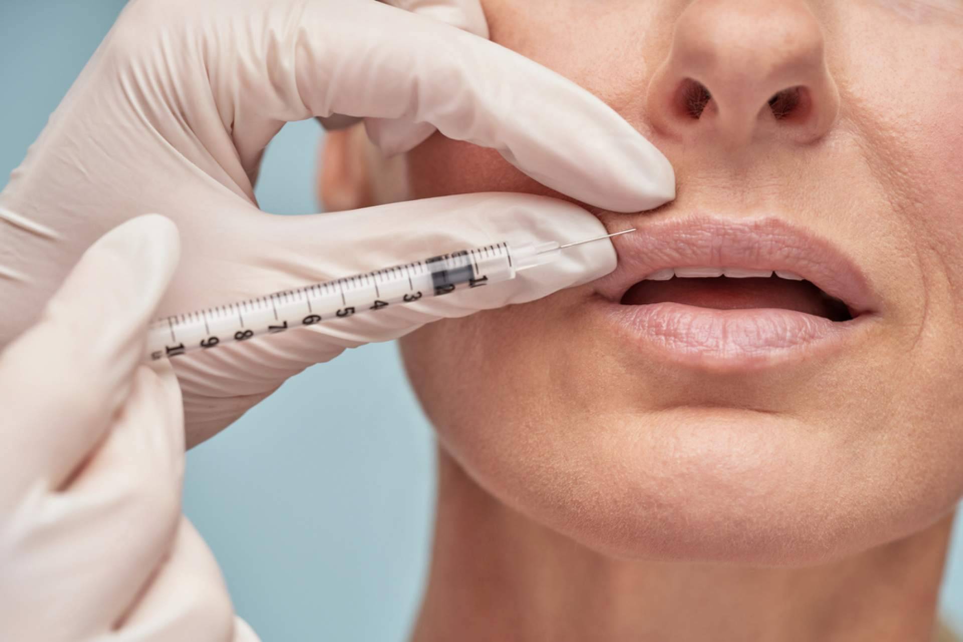 Centro Estetica el Pilar ofrece relleno de labios con ácido hialurónico para una belleza sin excesos