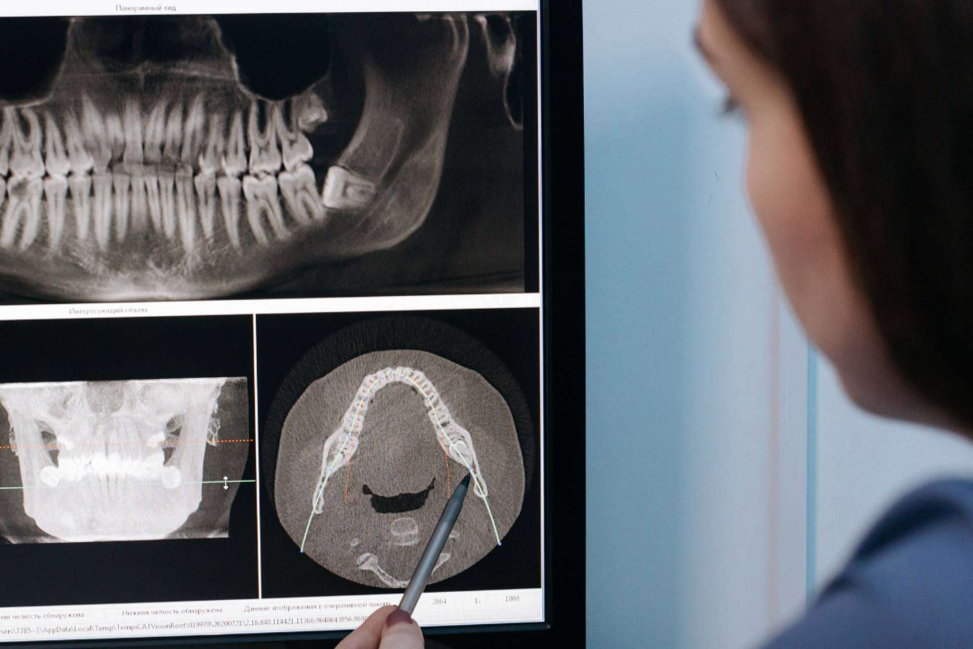 La clínica Denty Dent destaca en Madrid por su atención personalizada y el uso de tecnología odontológica puntera
