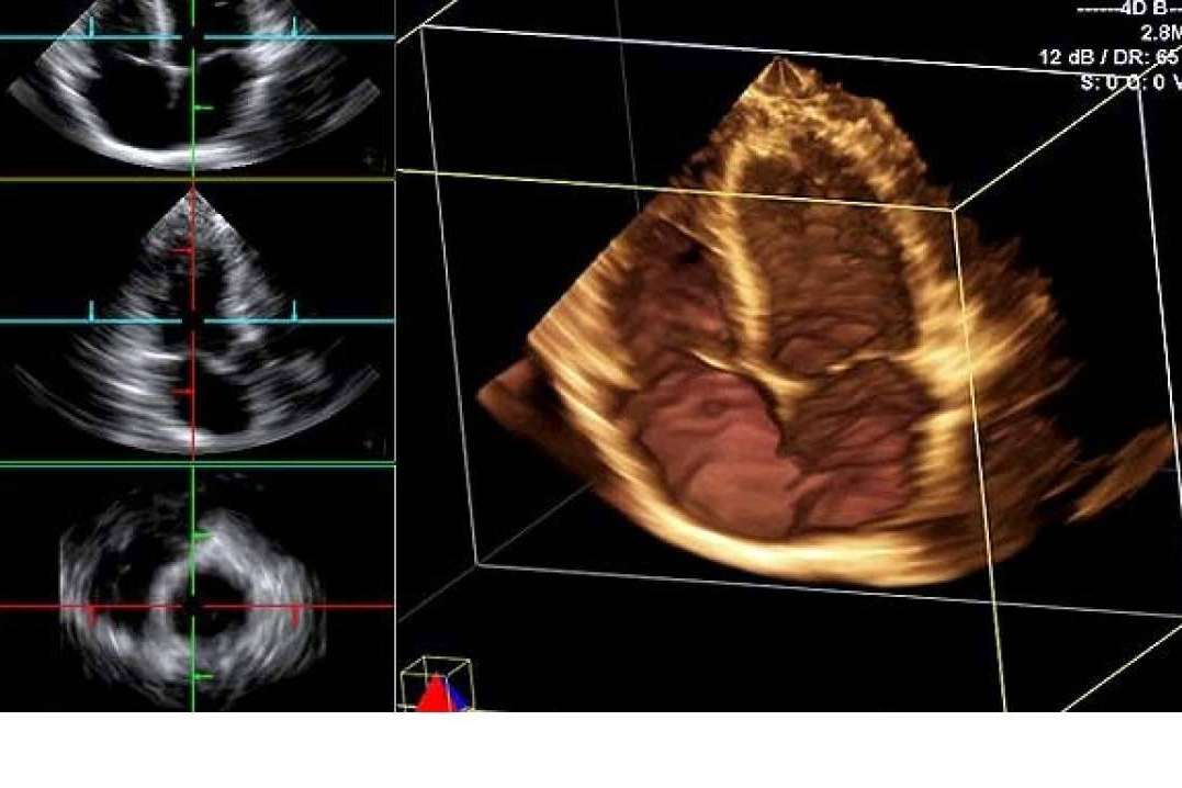 SCPmedical impulsa la modernización clínica con su variedad de ecógrafos a precios competitivos