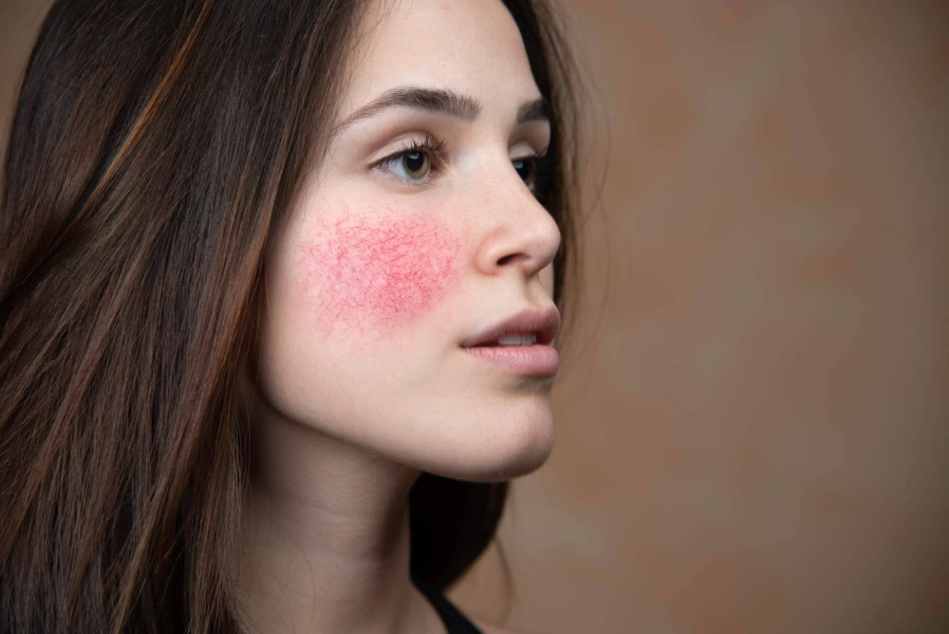Evoderm, dermocosmética eficaz con ingredientes limpios y aval profesional