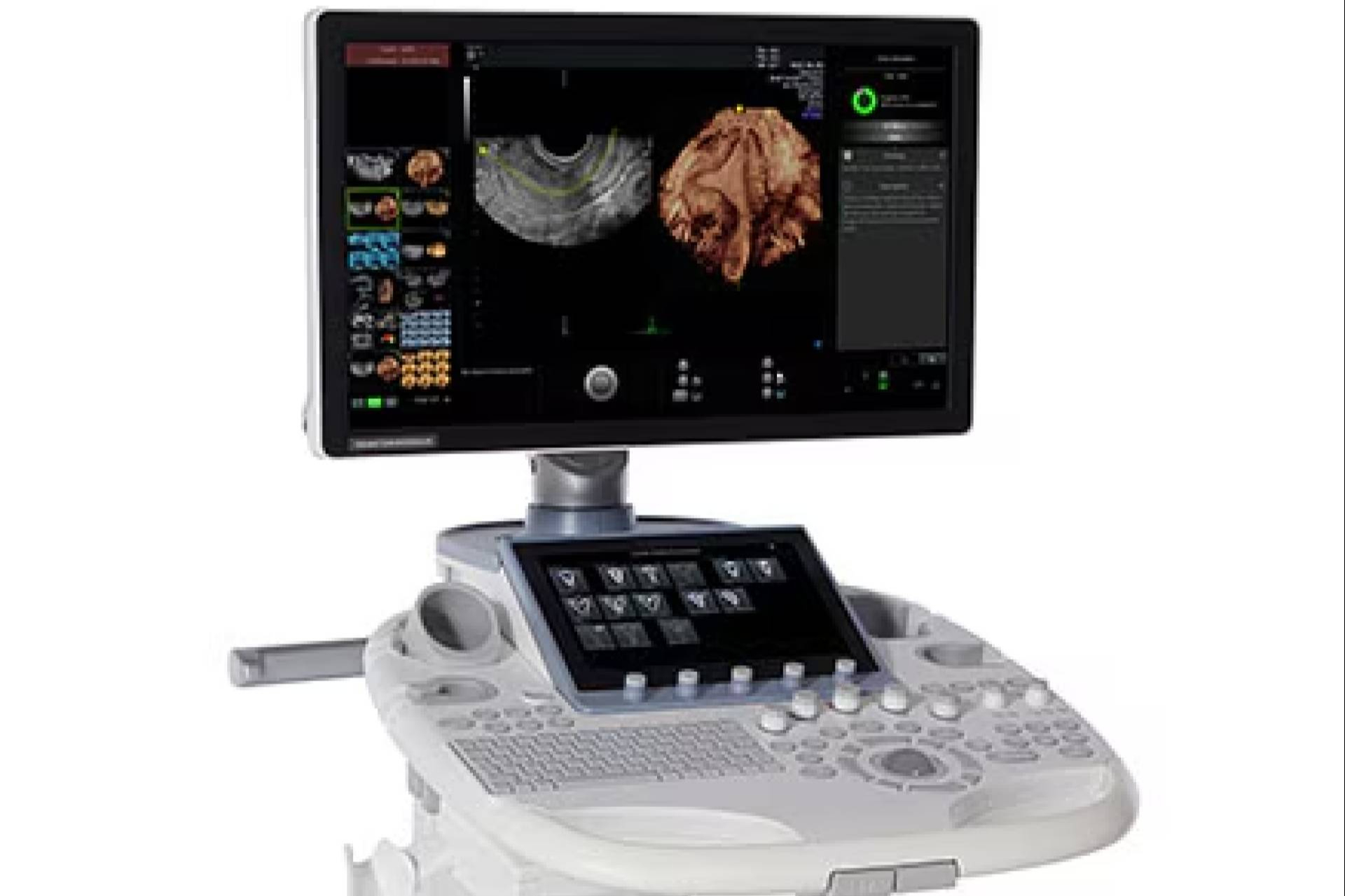 Innovación y soporte directo en sistemas de diagnóstico por imagen con SCP Medical