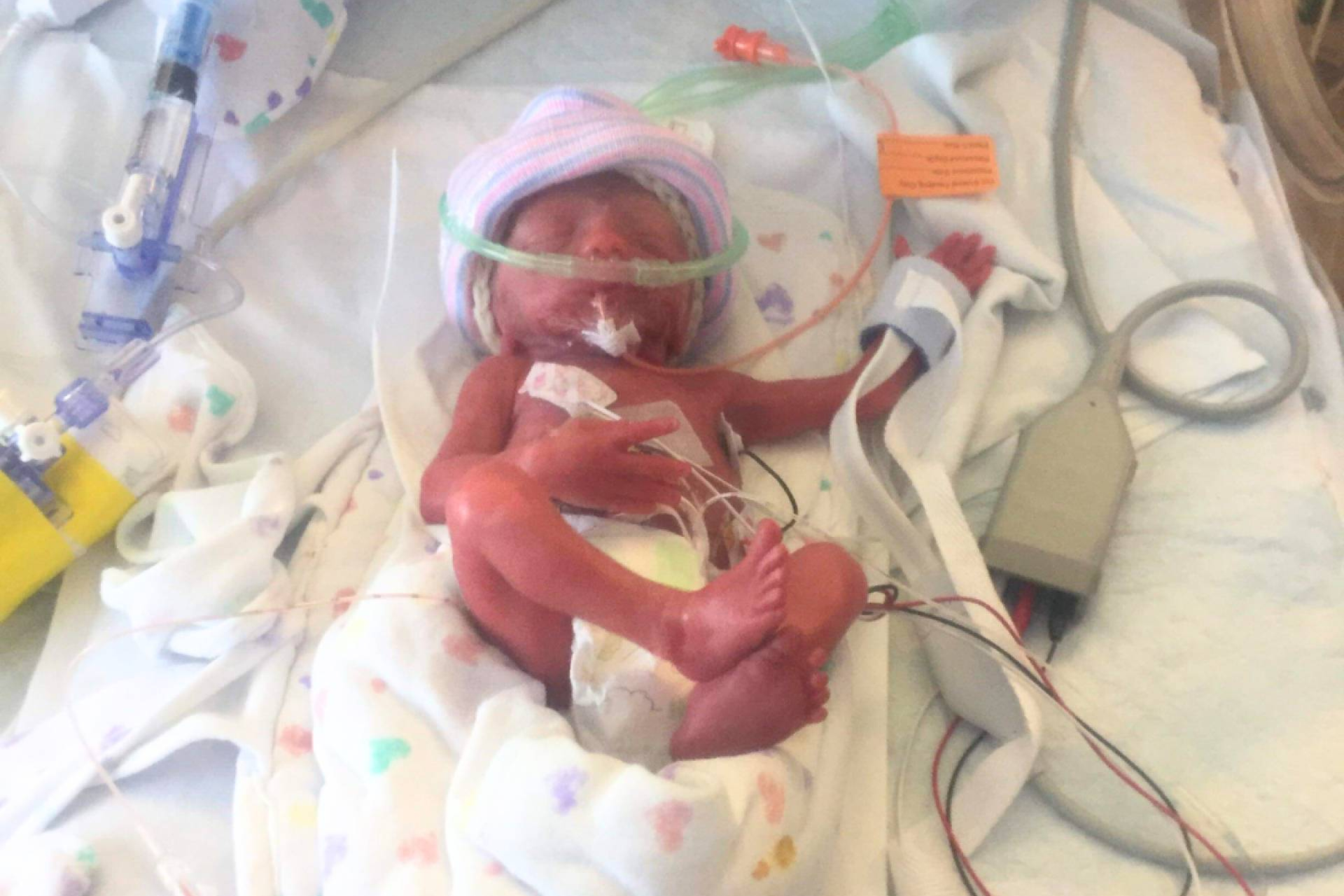 Prematuridad y acompañamiento, la experiencia de familias de bebés prematuros