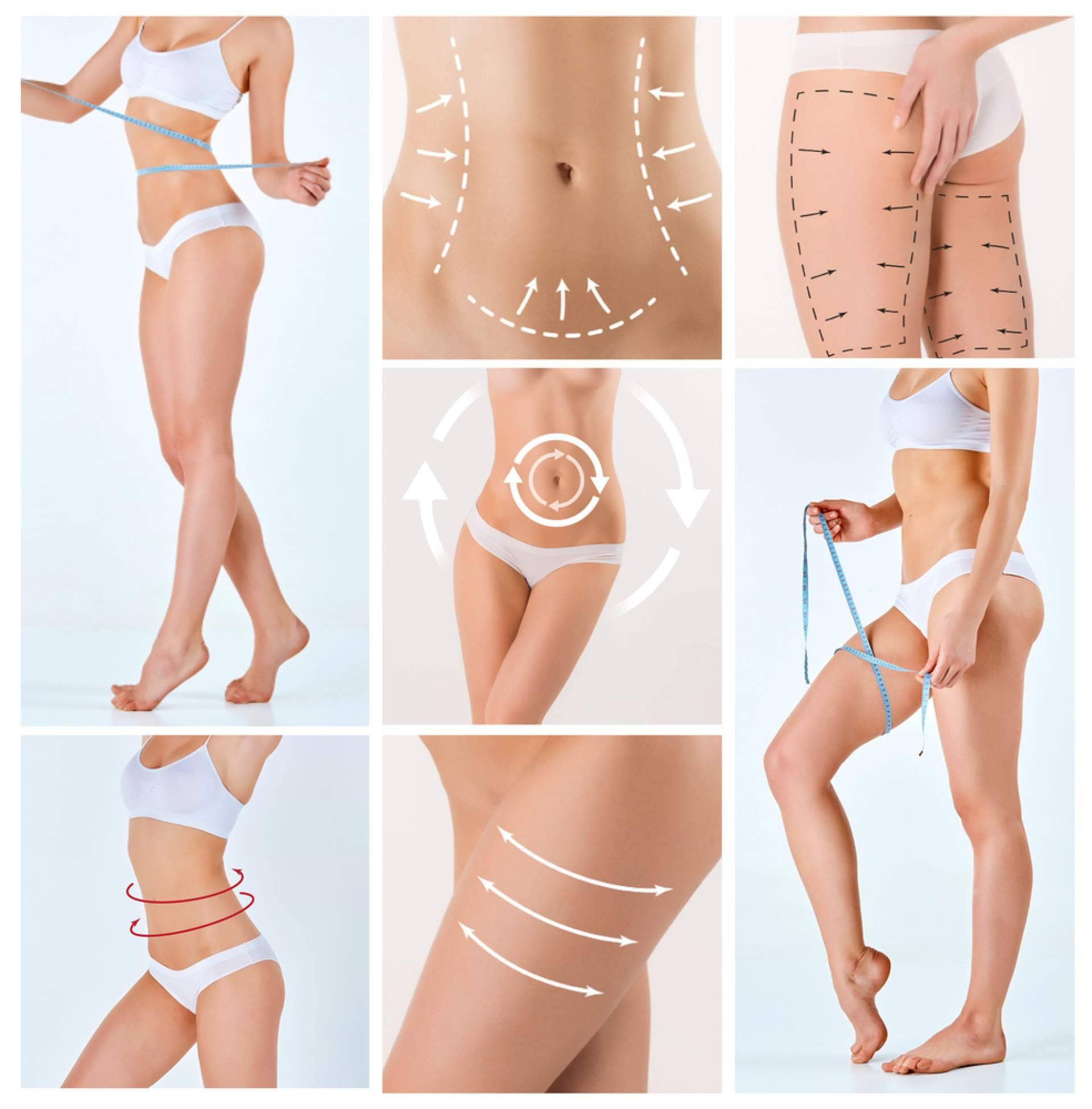 Lipoescultura HD con Lipováser; resultados más definidos en cirugía corporal con Beauty&Beauty